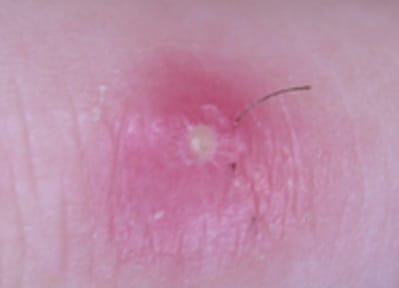 Dscn2701 cammdn - Eugenol