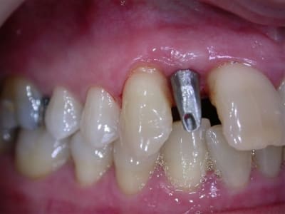 Dscn3219 ivtuie - Eugenol