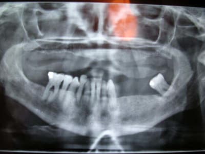 Dscn3355 uvwmmh - Eugenol