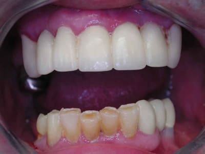 Dscn3375 wtjkhj - Eugenol