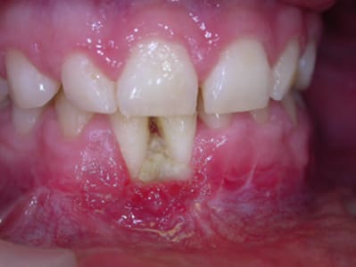 Dscn3405a cjuhqo - Eugenol