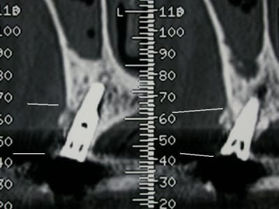 Dscn3901 ivr3bv - Eugenol