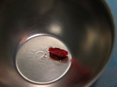 Dscn4439 jtrr4b - Eugenol