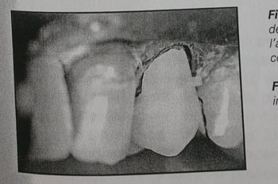 Dscn4667 g5yn7p - Eugenol