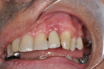 Dsc 0001 bnkk9k - Eugenol