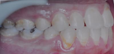 Dsc 0001 ffpgtq - Eugenol