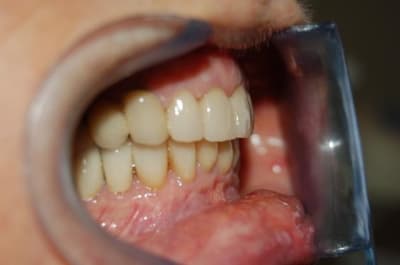 Dsc 0002 k521hq - Eugenol