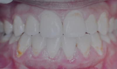 Dsc 0002 rvdtma - Eugenol