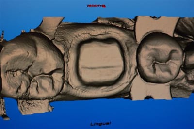 Dsc 0004 th8pvd - Eugenol