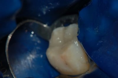 Dsc 0004 zam2re - Eugenol