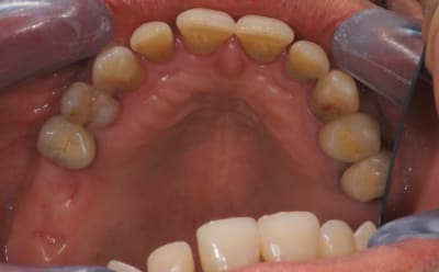 Dsc 0005 1 lyk6il - Eugenol