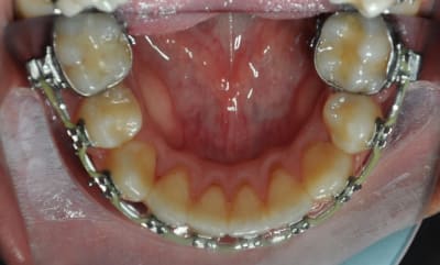 Dsc 0006 y2zwej - Eugenol
