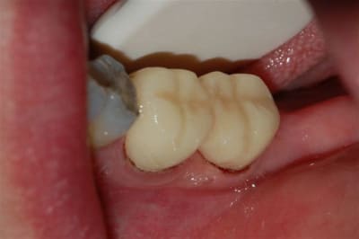 Dsc 0007 pbzkan - Eugenol
