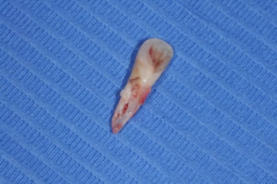 Dsc 0013 ynzgkk - Eugenol