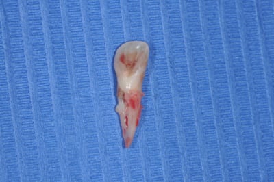 Dsc 0014 equwk5 - Eugenol