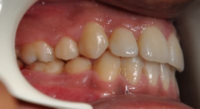 Dsc 0017 zlcnnp - Eugenol