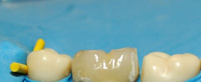 Dsc 0019 ymheyq - Eugenol