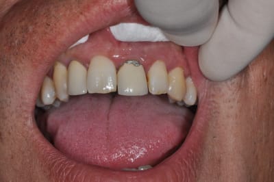 Dsc 0023 opbml9 - Eugenol