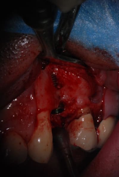 Dsc 0031 sydi9c - Eugenol