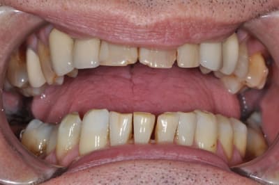 Dsc 0041 je96ca - Eugenol