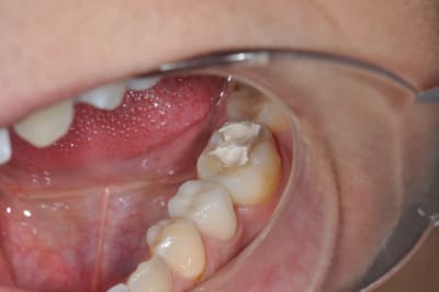 Dsc 0077 ruoeah - Eugenol