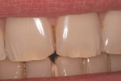 Dsc 0105 myu56r - Eugenol