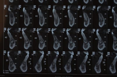 Dsc 0111 k8eigs - Eugenol