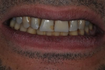 Dsc 0232 sim5hs - Eugenol