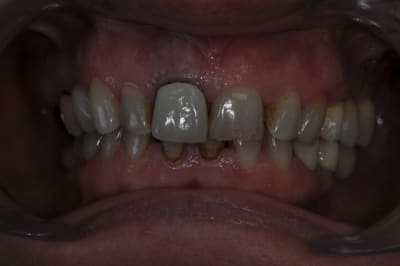 Dsc 0313 t3x0du - Eugenol