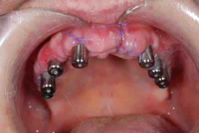Dsc 0331 dqwxh7 - Eugenol