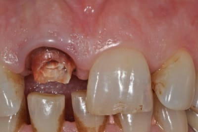 Dsc 0331 myy9l7 - Eugenol