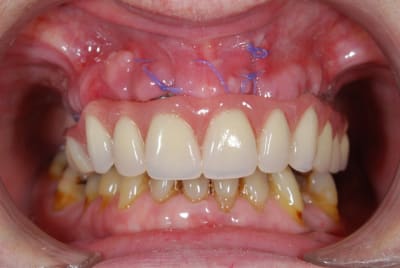 Dsc 0335 tqqh2y - Eugenol