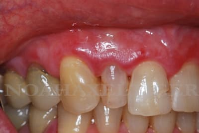 Dsc 0336 owiogw - Eugenol