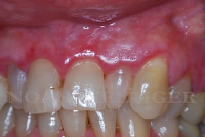 Dsc 0338 fygt0v - Eugenol