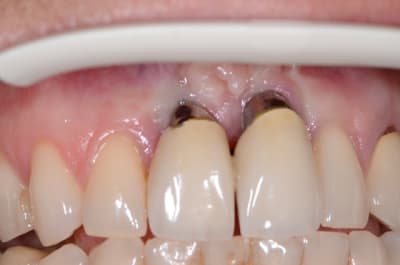 Dsc 0354 ptpq0f - Eugenol