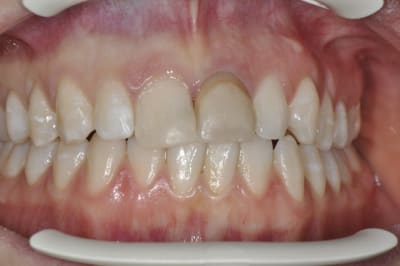 Dsc 0414 duiyxc - Eugenol