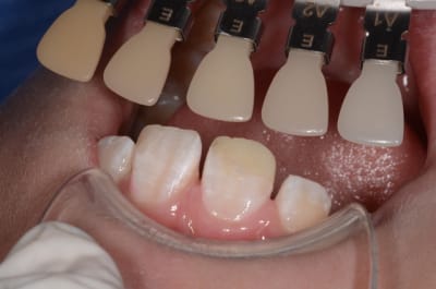 Dsc 0507 bpjwvp - Eugenol