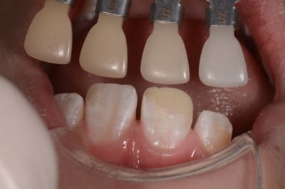 Dsc 0511 fqprrg - Eugenol