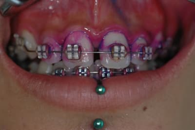 Dsc 0531 lqrvgj - Eugenol
