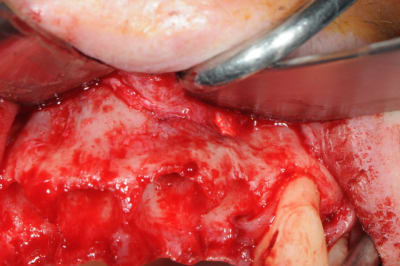 Dsc 0606 n3ucwa - Eugenol