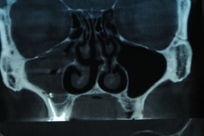 Dsc 0666 n3y9ju - Eugenol