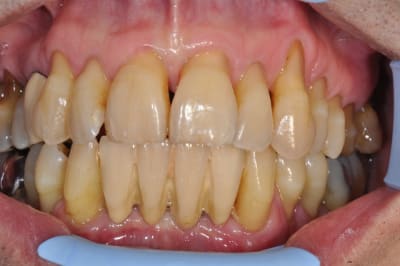 Dsc 0713 mpa4pq - Eugenol