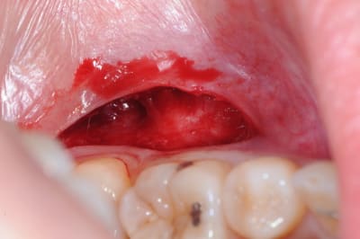 Dsc 0853 o2u5mi - Eugenol