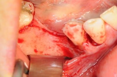 Dsc 1399 o3lkdf - Eugenol