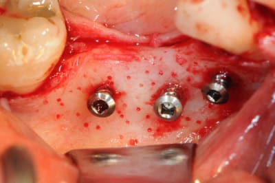 Dsc 1406 b9qo3f - Eugenol