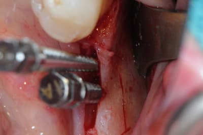 Dsc 1422 eiffdt - Eugenol