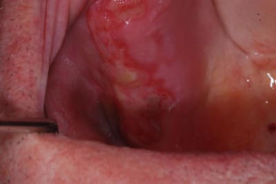 Dsc 1532 skjpq1 - Eugenol