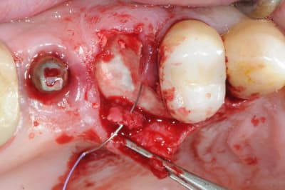 Dsc 1554 n8nngl - Eugenol