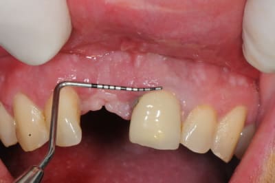 Dsc 1570 sqqj24 - Eugenol