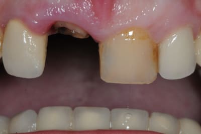 Dsc 1582 stholi - Eugenol